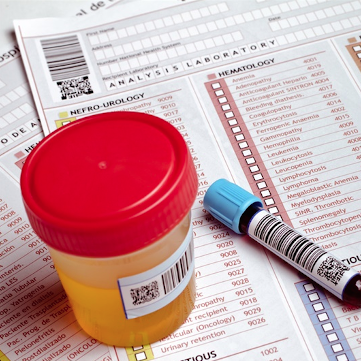 how to beat etg test